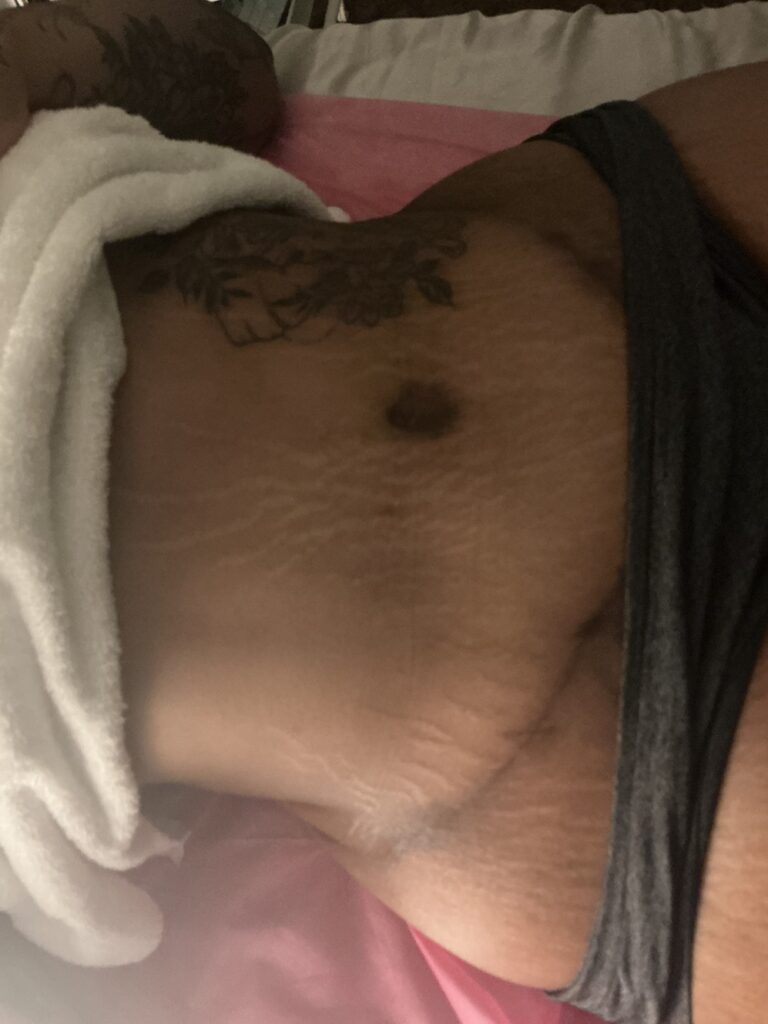 Home gifted hands body sculpting massage before treatment