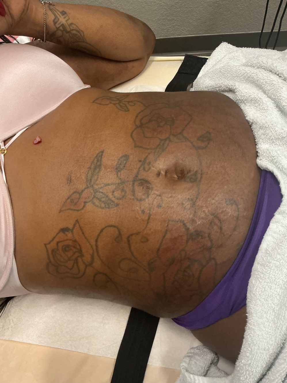 gifted hands health wellness body contouring massage after treatment