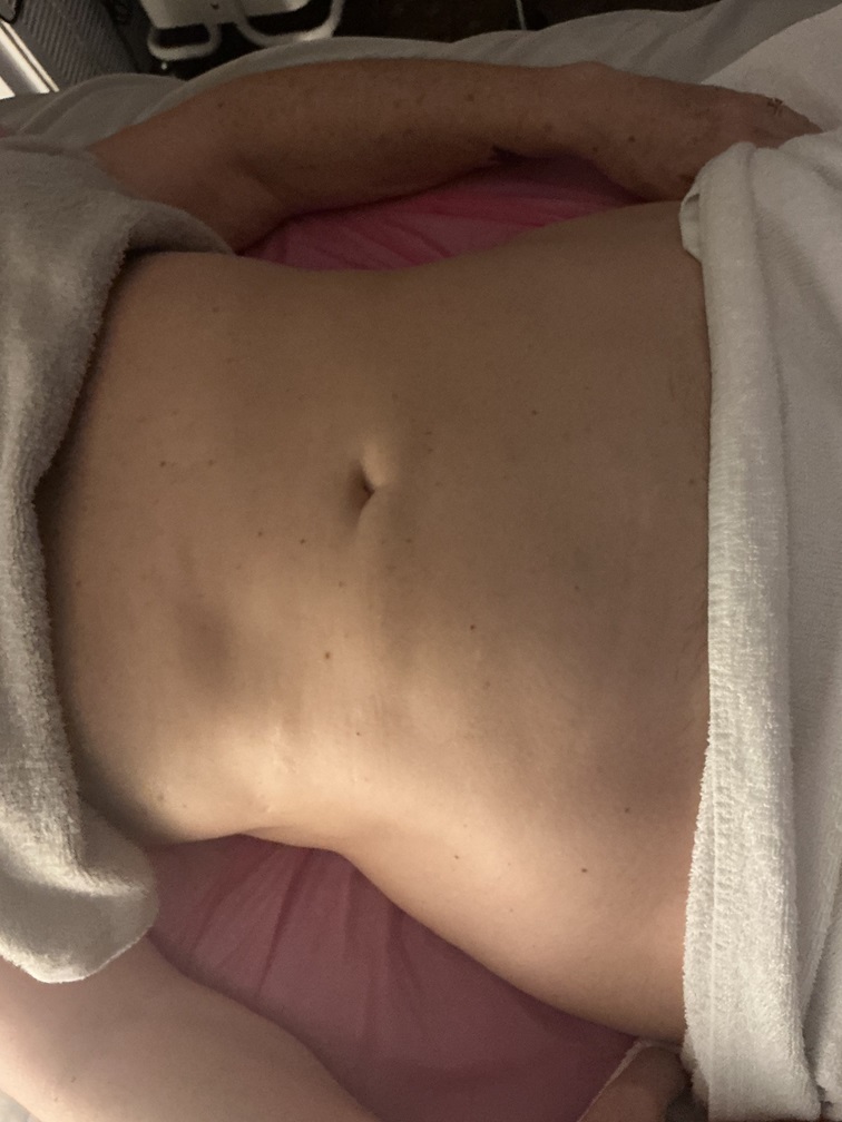 Home gifted hands lymphatic massage arlington tx before treatment