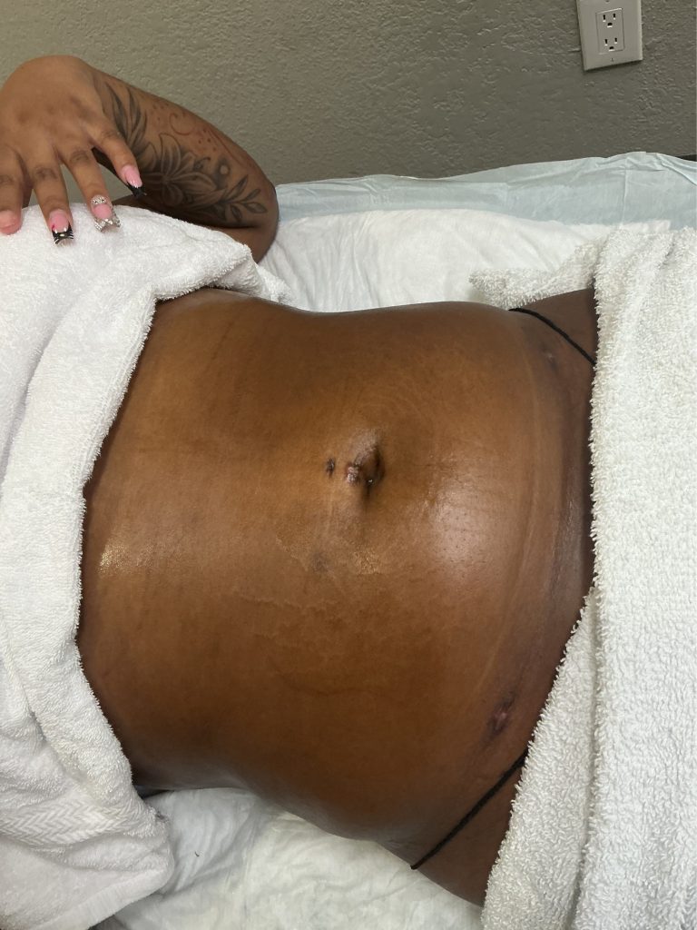 Glutathione & Body Contouring: Supporting Your Results from the Inside Out 19