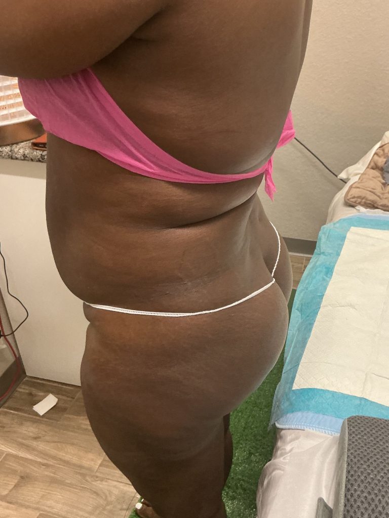 30
