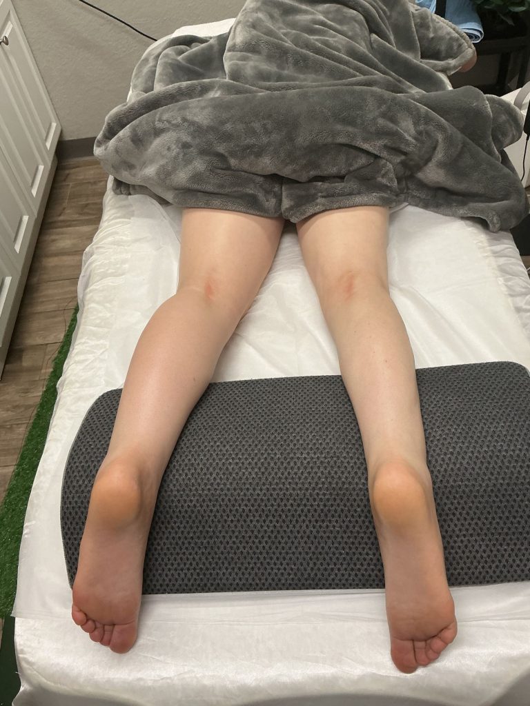 The Science Behind Summer Swelling: How the DFW Heat Wave Affects Your Lymphatic System 36